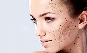 Ameliyatsız İple Yüz Gerdirme