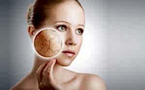 ankara çatlak tedavisi