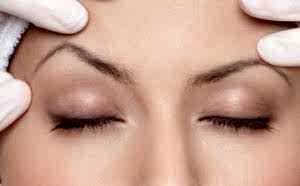 Kaş Arası Kırışıklık Dolgusu