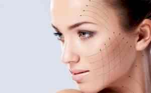 Ameliyatsız İple Yüz Gerdirme