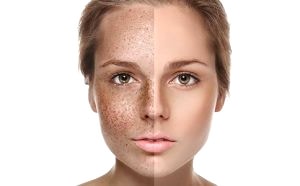 Ameliyatsız Ben Aldırma Tedavisi