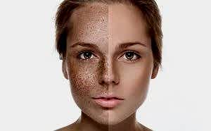 Ameliyatsız Ben Aldırma Tedavisi