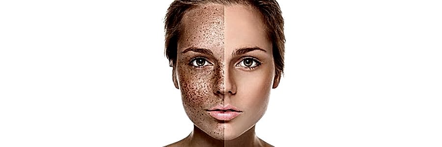 Ameliyatsız Ben Aldırma Tedavisi